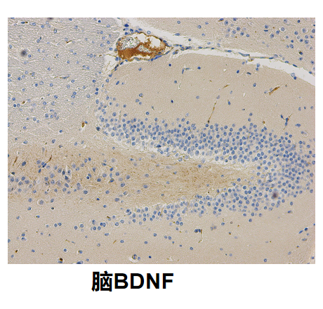 脑BDNF.png