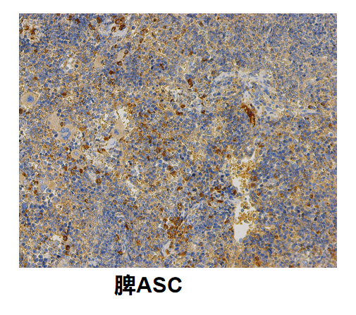 脾ASC.png