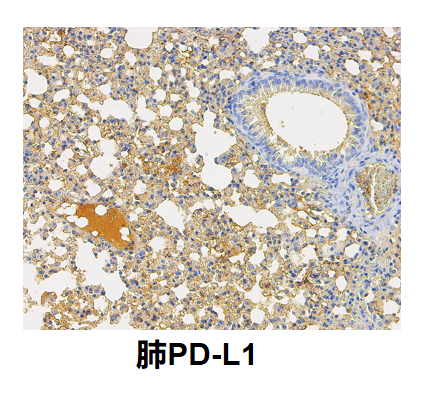 肺PDL1.png