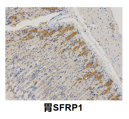 胃SFRP 1.png