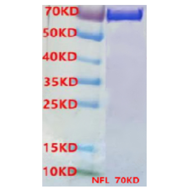 NFL-重组蛋白