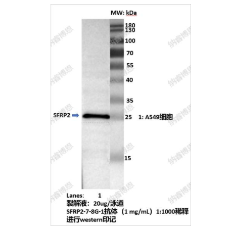 Anti-SFRP2抗体